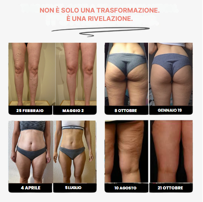 Leggings 3D Fittabella – Redefine tu silueta sin esfuerzo