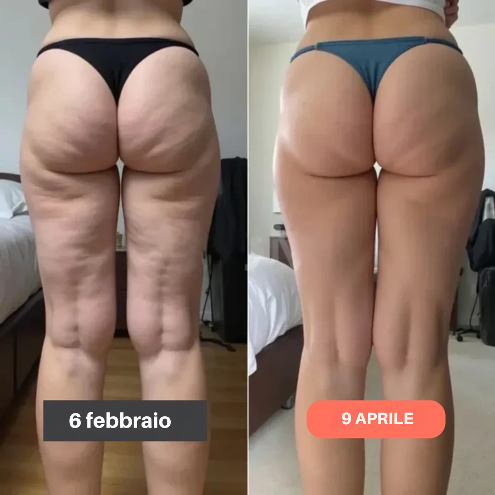 Leggings 3D Fittabella – Redefine tu silueta sin esfuerzo