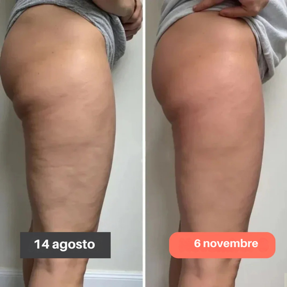 Leggings 3D Fittabella – Redefine tu silueta sin esfuerzo